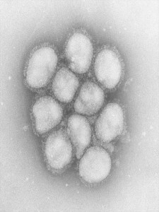 インフルエンザウイルス